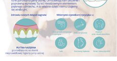 infografika_przyczyny chorób dziąseł.jpg