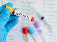 Lipidogram u 6-latków - wskazana prewencja chorób krążenia