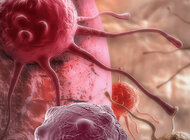 Zakłócanie szlaku NMD w komórkach nowotworowych. Krok w kierunku pokonania raka