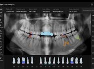 Align Technology wprowadza innowacje dla przyspieszenia cyfryzacji praktyki stomatologicznej