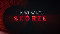 Na własnej skórze - grafika.jpg