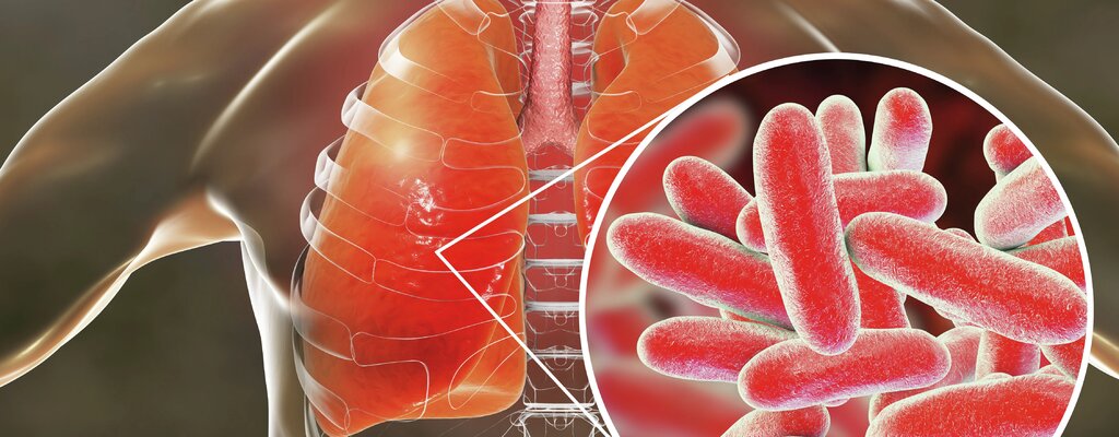 "Legionella pneumophila" pod okiem naukowców z SGGW