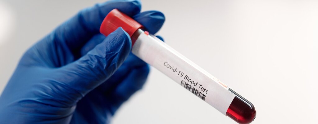 Pracodawca może zorganizować testy na SARS-CoV-2 w ramach ubezpieczenia