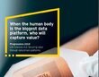 teaser Firmy z sektora ochrony zdrowia mogą przegrać wyścig z firmami technologicznymi